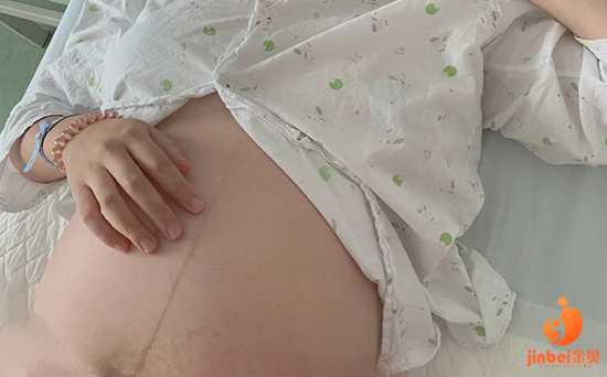 胎停X染色体异常_子宫次切除后怀孕_【山东私立供卵医院供卵试管婴儿需要多久