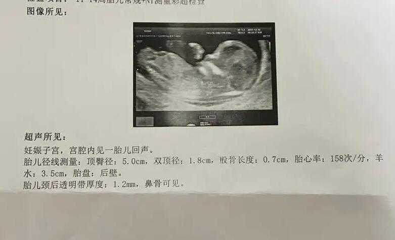 杭州哪个助孕医院好私立机构 浙江做试管比较出名的医院有杭州邵逸夫医院吗