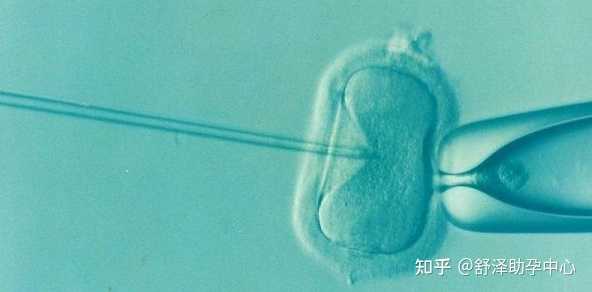 浙江做试管该如何选择医院,浙江人工受孕哪个医院最好？
